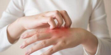 Rekomendasi Dokter Kulit di Semarang Paling Bagus