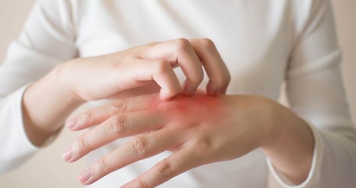 Rekomendasi Dokter Kulit di Semarang Paling Bagus
