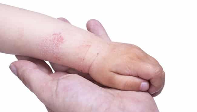 8 Rekomendasi Dokter Kulit di Semarang