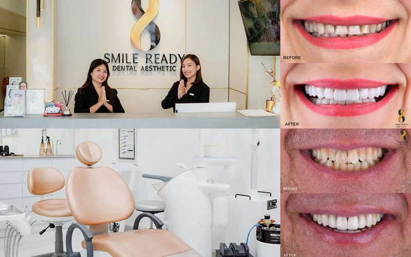 Smile Ready Bali Dentist
Dental Clinic Bali